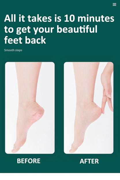 8 in 1Professional Pedicure Foot Spa Set, Pedicure Set for Feet,Stainless Steel Foot Care Kit, Foot Rasp Dead Skin Remover